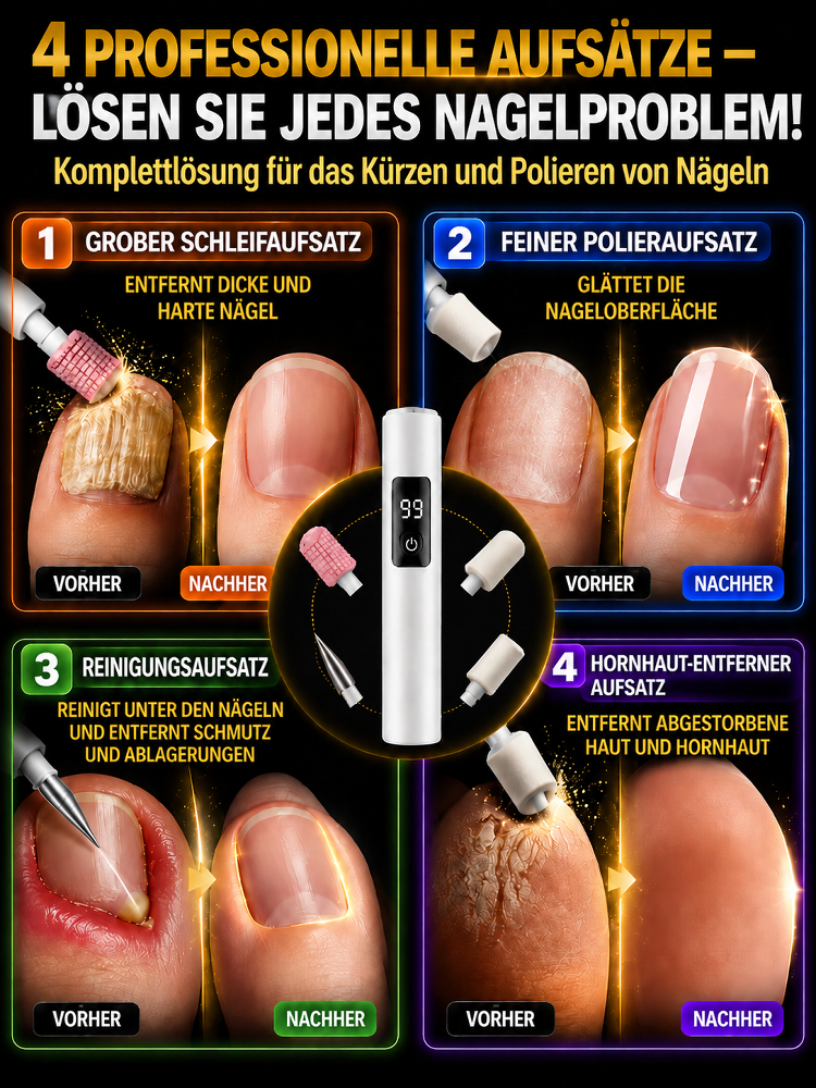 50%OFF! Schöne, gesunde Nägel in Minuten – erleben Sie professionelle Pflege zu Hause!