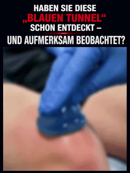 🔥 Gelenkschmerzen in 15 Minuten verschwunden?  Einfach auftragen und starke Schmerzen sowie Schwellungen verschwinden sofort!