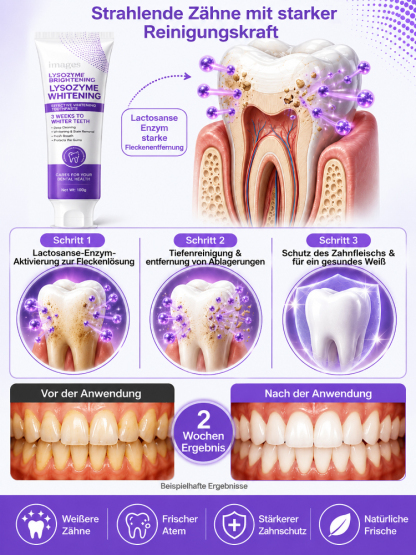 Stern-Diamant Nano Whitening Zahnpasta