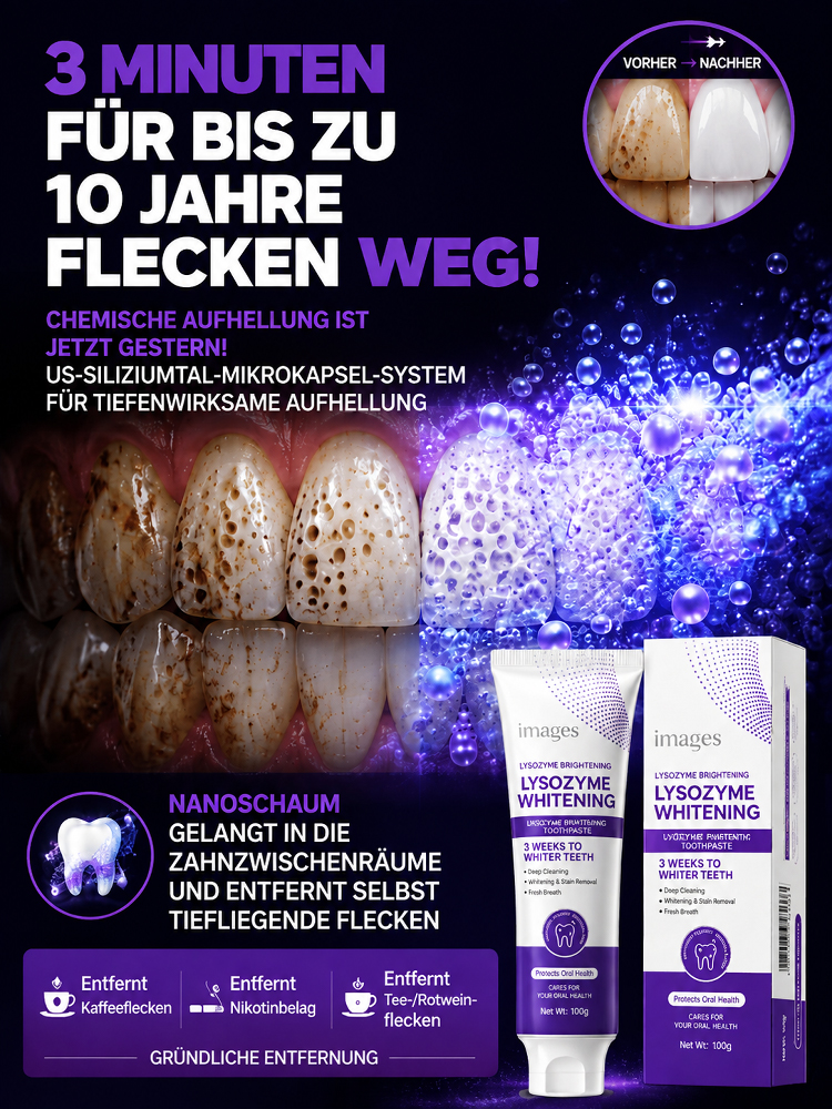 Stern-Diamant Nano Whitening Zahnpasta