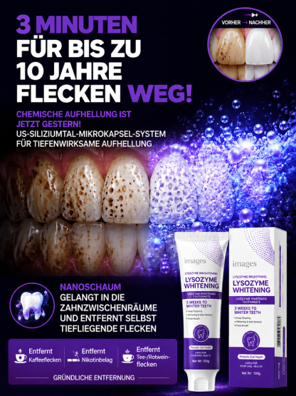 Stern-Diamant Nano Whitening Zahnpasta