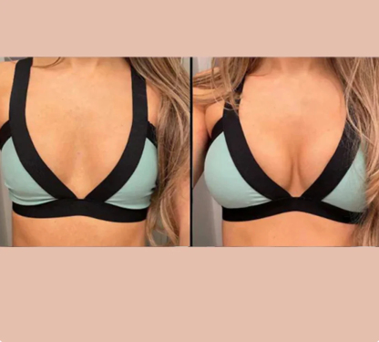 ULTRA LIFT STICKY BRA INSERTS