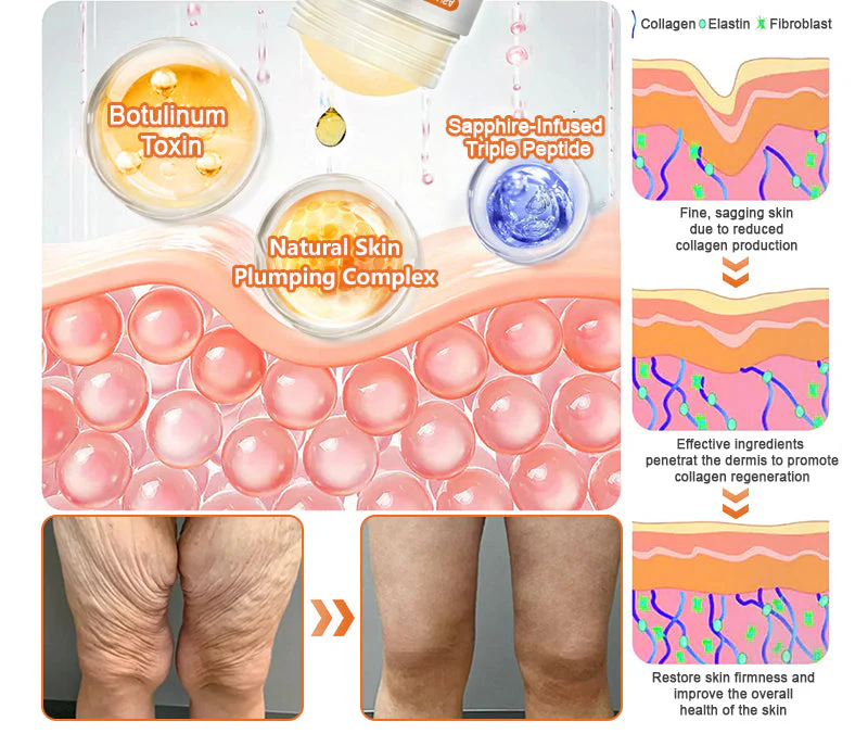 Eliminating cellulite and firming thighs