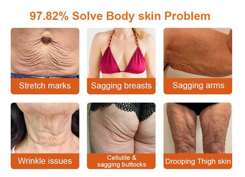 Solve body skin problem