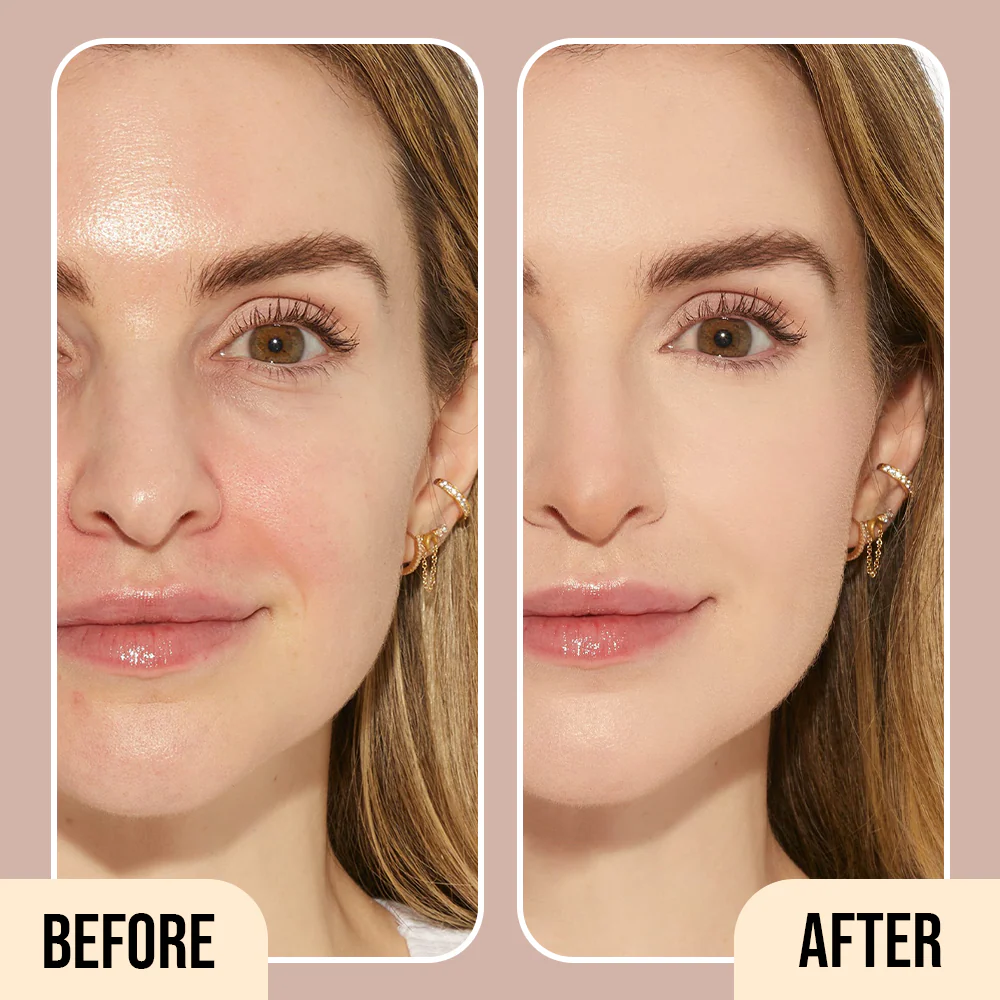 Before and After