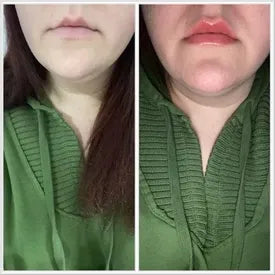Customer lip plumping result