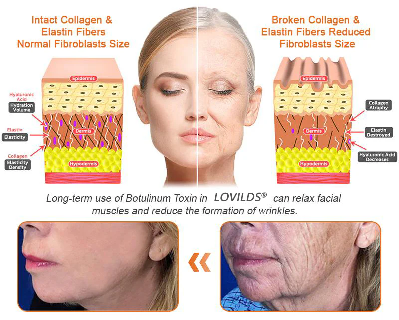 Diminishing the visibility of wrinkles