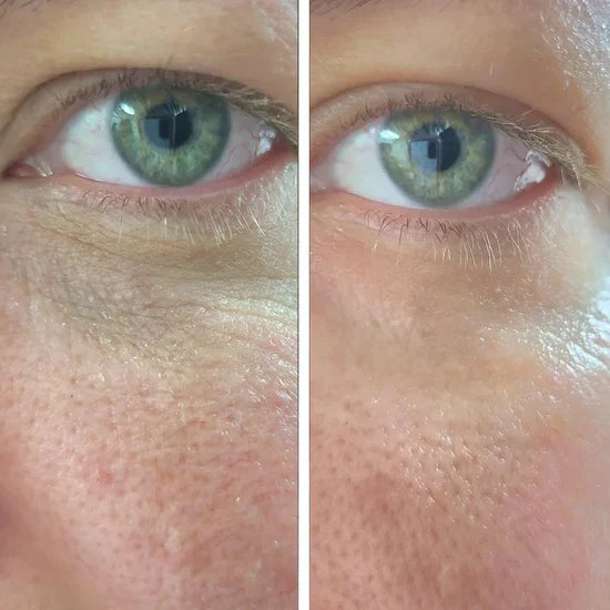 The Non-Invasive Facelift review