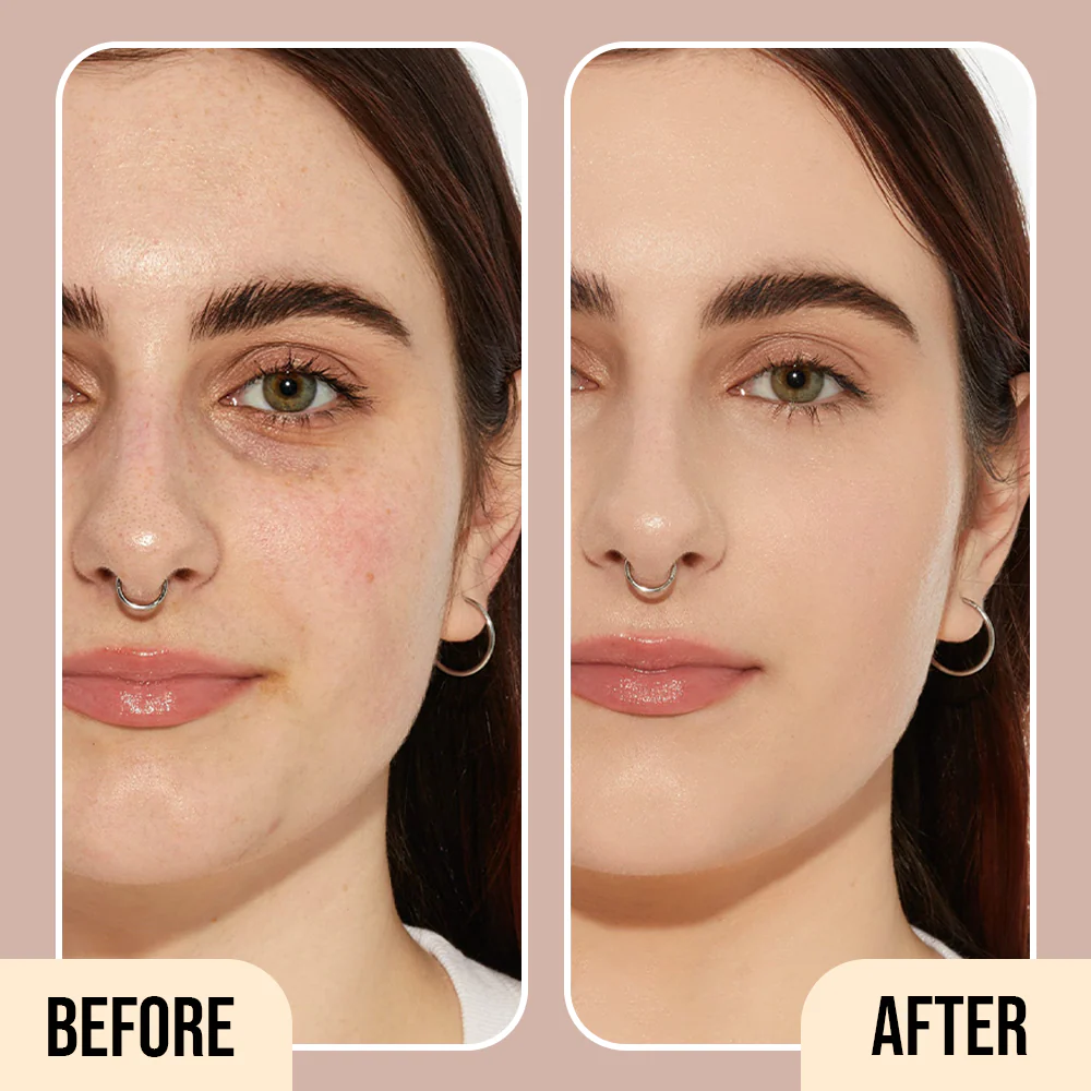 Before and After