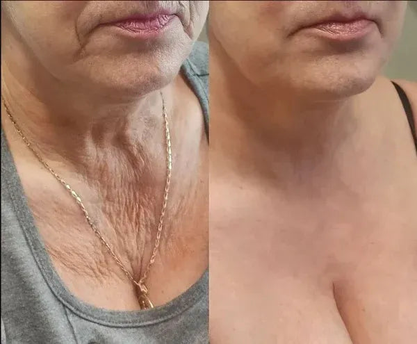 Before and after user results
