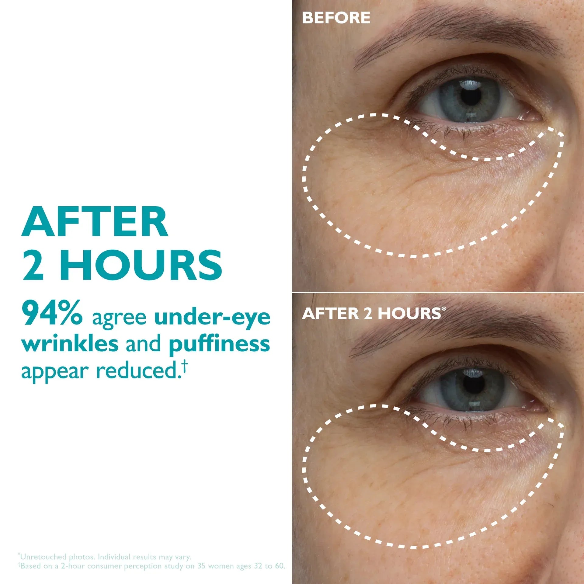 After 2 hours visible results