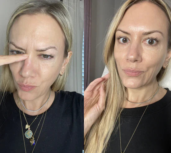 Absolute Best for Glass Skin review
