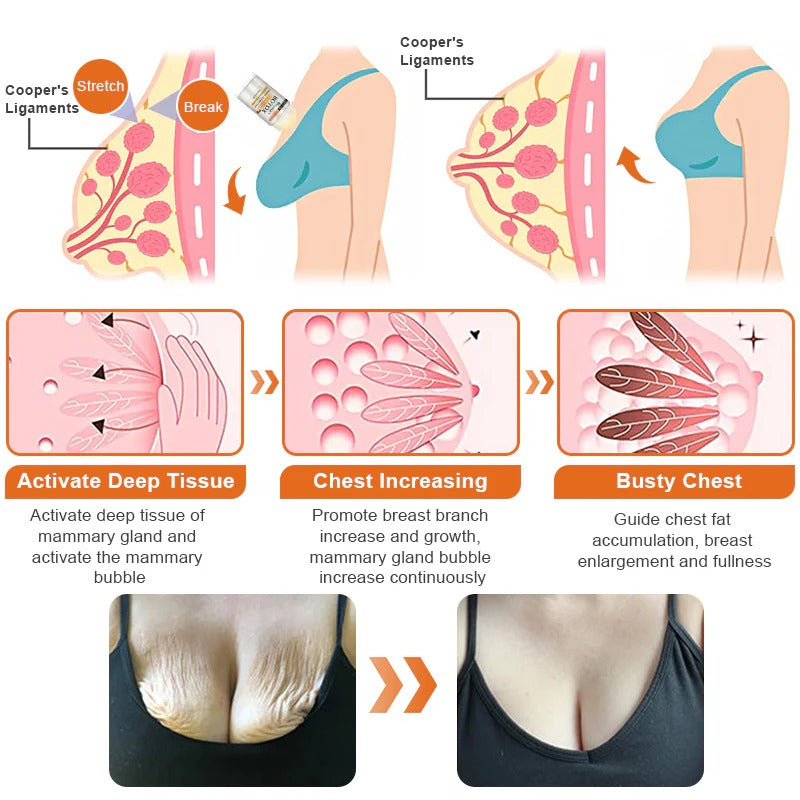 Breast enhancement and uplift