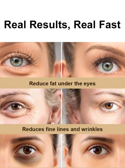 ✨Instant wrinkle reduction in just 1 use! Anti-Wrinkle & Smoothing Eye Serum Oil