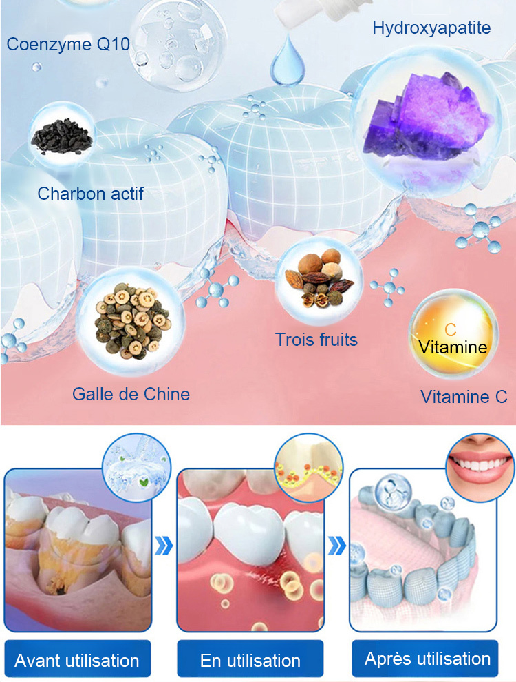 【Approuvé par les dentistes】Sérum protecteur dentaire spécialisé pour la régénération de l'émail dentaire