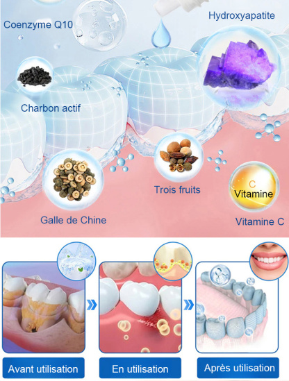 【Approuvé par les dentistes】Sérum protecteur dentaire spécialisé pour la régénération de l'émail dentaire