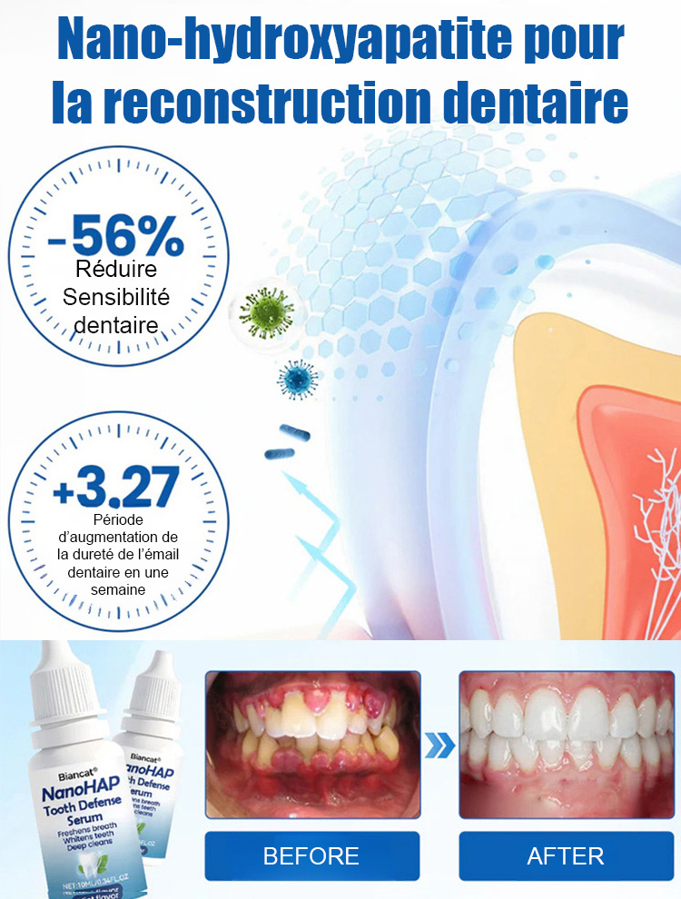 【Approuvé par les dentistes】Sérum protecteur dentaire spécialisé pour la régénération de l'émail dentaire