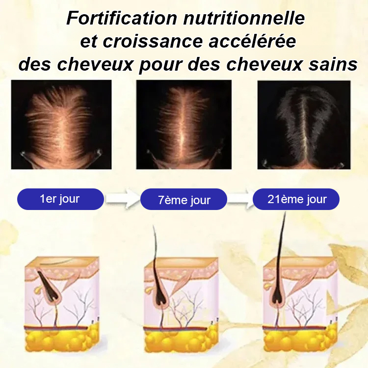 Sérum roll-on pour la prévention de la chute des cheveux, renforcement des racines et croissance cap