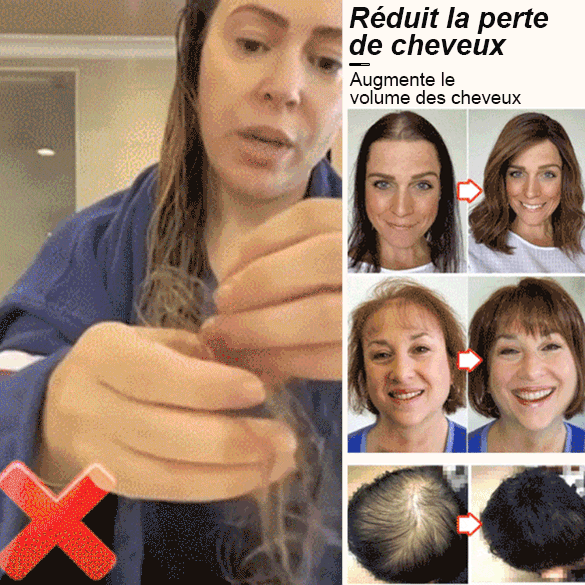 Sérum roll-on pour la prévention de la chute des cheveux, renforcement des racines et croissance cap