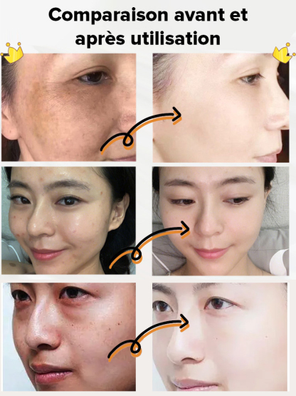 Crème Éclaircissante Anti-Taches Profonde