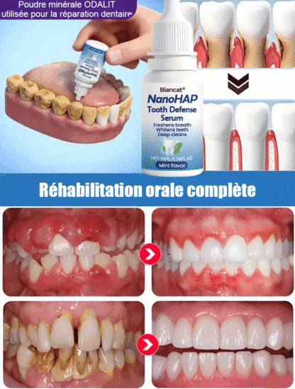 【Approuvé par les dentistes】Sérum protecteur dentaire spécialisé pour la régénération de l'émail dentaire