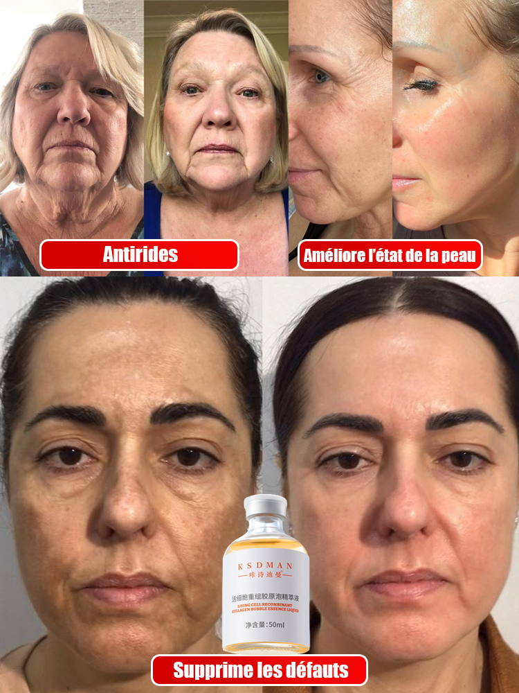 🧬 Collagène Recombinant (ADN de Saumon) : Le secret de la Régénération profonde. 🧬