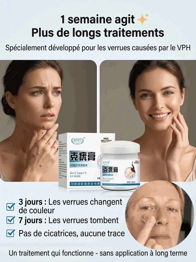🔥 Pommade anti-verrues indolore – Action immédiate