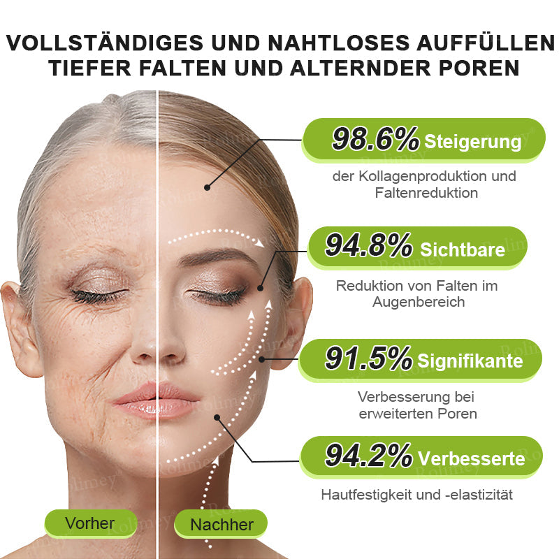 Rolimey® Retinol & Botox Shot ✓ Dermatologisch getestete Lifting-Creme