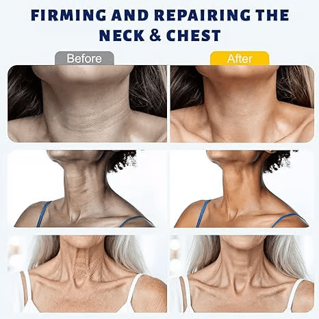 ✨ Roller Massage Cream  — 🧴 Infused with Retinol & Hyaluronic Acid | Firms the Neck, Reduces Wrinkles & Double Chin