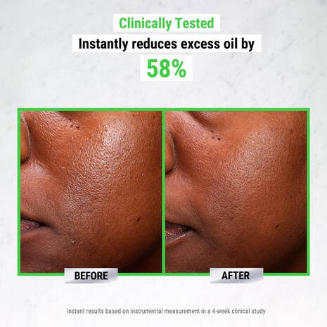 Ultra Pure High-Potency 5.0% Niacinamide Serum