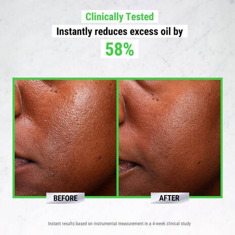 Ultra Pure High-Potency 5.0% Niacinamide Serum