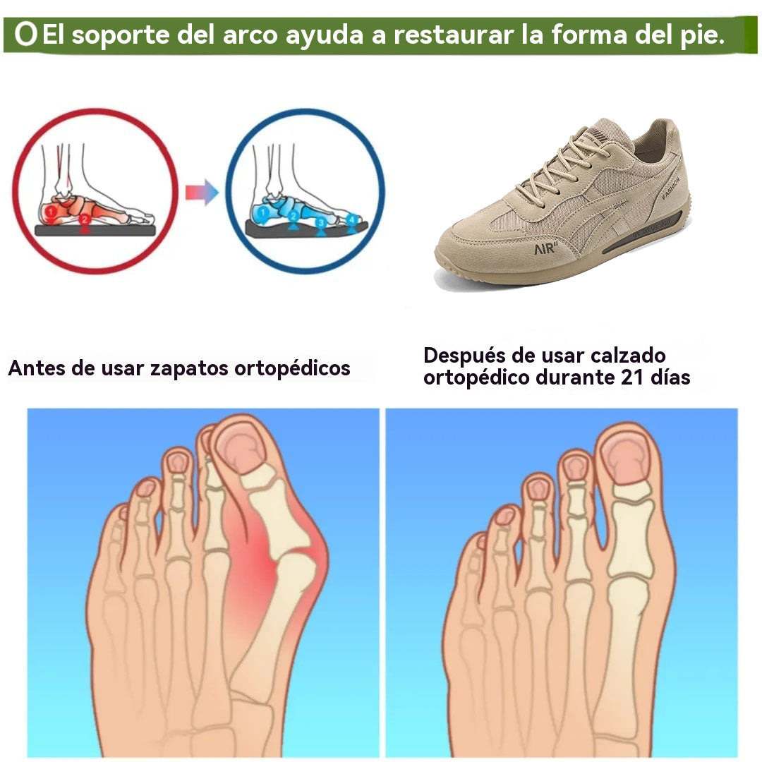 Nuevo producto en el mercado, a mitad de precio por tiempo limitado. Diseño ergonómico, excelente amortiguación y corrección de la marcha