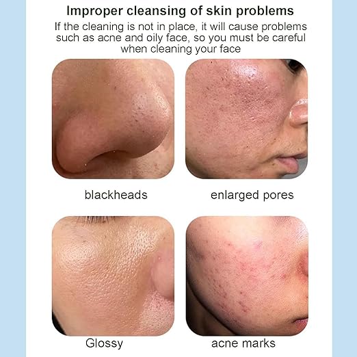 Centella Asiatica Bubble Mask