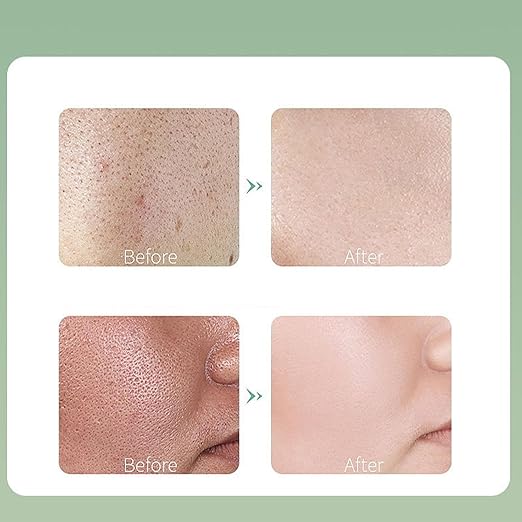 Centella Asiatica Bubble Mask