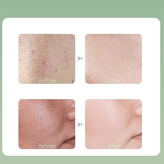 Centella Asiatica Bubble Mask