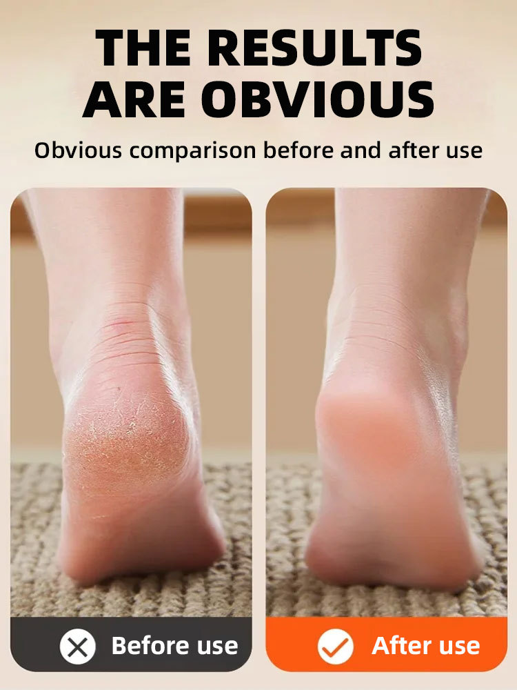 Buy 1 Get 1 Free! Buy 2 Get 2 Free! 🦶Electric foot scrubber✨👡 One-Touch Smoothing: Reclaim Baby-Soft Feet.