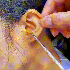 6 Precision Tools✨6-piece Stainless Steel Ear Scoop Set👂ASMR For Your Ears: Redefining the New Standard of Ear Canal Cleaning.