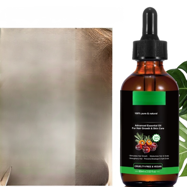 The "Miracle Oil" for Instant Growth, Thicker, Longer, Stronger Hair! Experience the 100% Raw Batana "Growth Surge" Today.