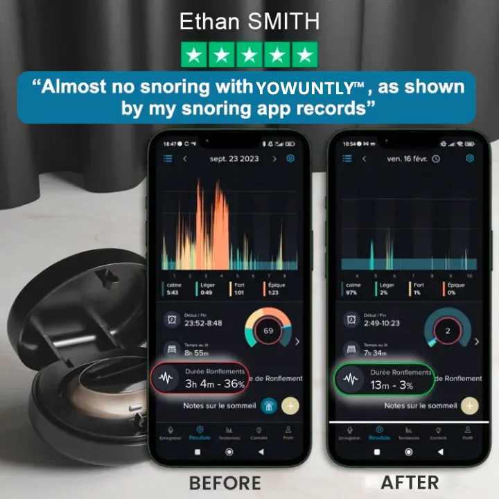 ✨YOWUNTLY™ Professional Anti-snoring Device