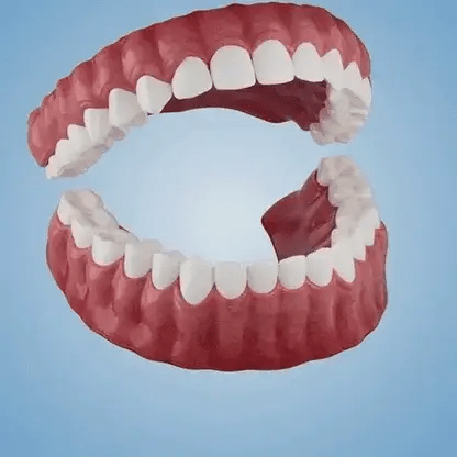 🌎Ends Today: 70% OFF! ⏰SkolayVita™ Medical Full Denture with Strong Suctiond🦷Obtain Relevant Association Certification