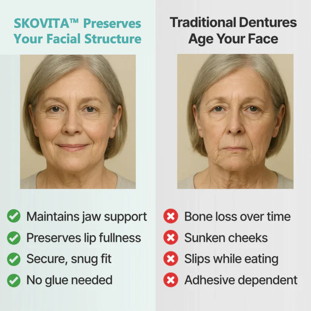 🌎Ends Today: 70% OFF! ⏰SkolayVita™ Medical Full Denture with Strong Suctiond🦷Obtain Relevant Association Certification