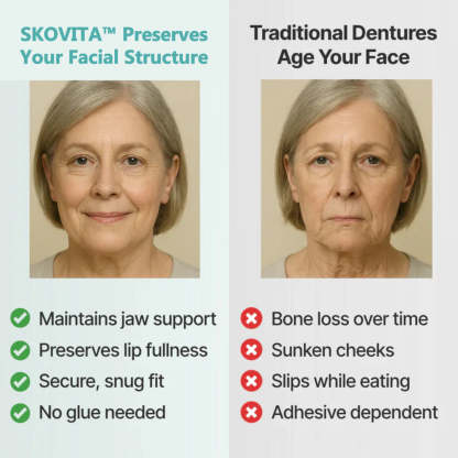 🌎Ends Today: 70% OFF! ⏰SkolayVita™ Medical Full Denture with Strong Suctiond🦷Obtain Relevant Association Certification