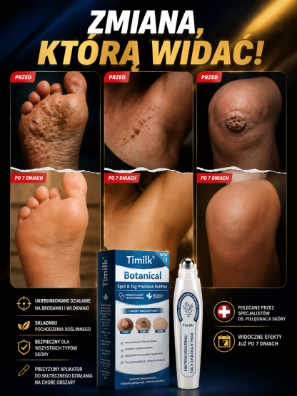 Precyzyjny i bezbolesny usuwacz kurzajek - długopis do regeneracji skóry🎁 SZALONA PROMOCJA: Mamy teraz ofertę KUP 1, A DRUGI OTRZYMASZ GRATIS + 10-krotna gwarancja zwrotu pieniędzy! 