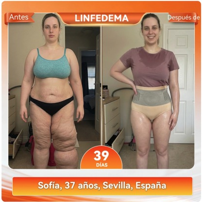 Moringa & Berberine 4-in-1 MicroparticleShorts for Sculpting and Fat Burning