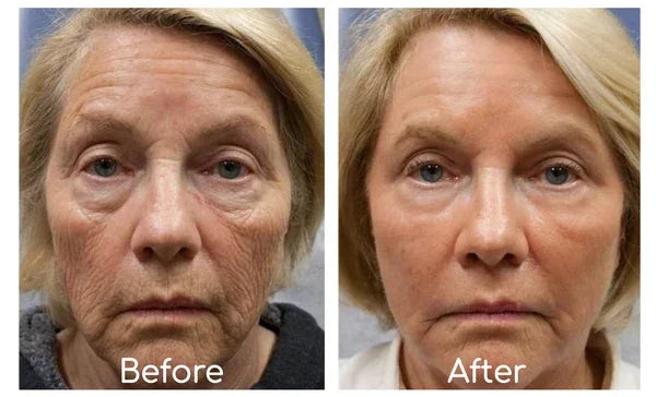 LOVILDS Bee Venom Wrinkle Removal Cream