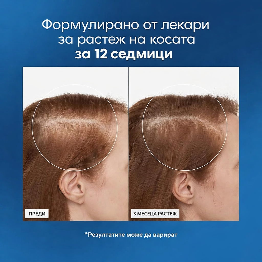 Be Bodywise Премиум ролков серум за стимулиране растежа на косата