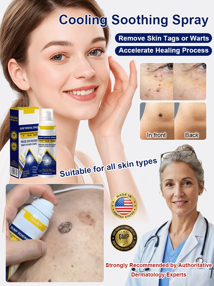 【👨‍⚕️✅Von Dermatologen empfohlen】🌟Kryotherapie-Warzenentfernungsspray aus den USA👍Schmerzfrei, narbenfrei, reizt die Haut nicht und wirkt dauerhaft💯100 % natürliche Formel, geeignet für alle Hauttypen, fördert die Hautregeneration