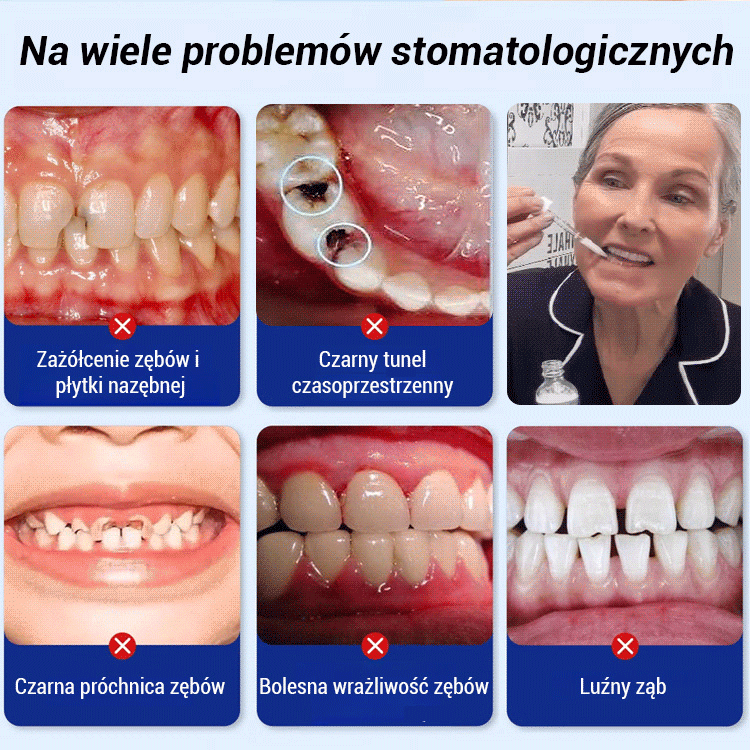 Płyn do pielęgnacji zębów丨Rekonstrukcja szkliwa zębów 🦷 Naprawia uszkodzone zęby i przywraca je do pierwotnego stanu