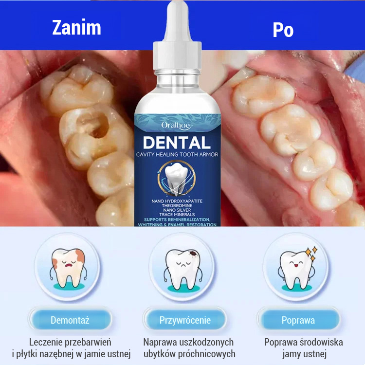 Płyn do pielęgnacji zębów丨Rekonstrukcja szkliwa zębów 🦷 Naprawia uszkodzone zęby i przywraca je do pierwotnego stanu