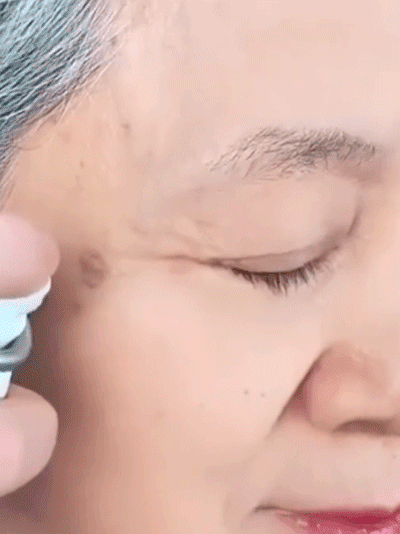 【Jedno psiknięcie, natychmiastowe usunięcie】Wybielający spray na przebarwienia